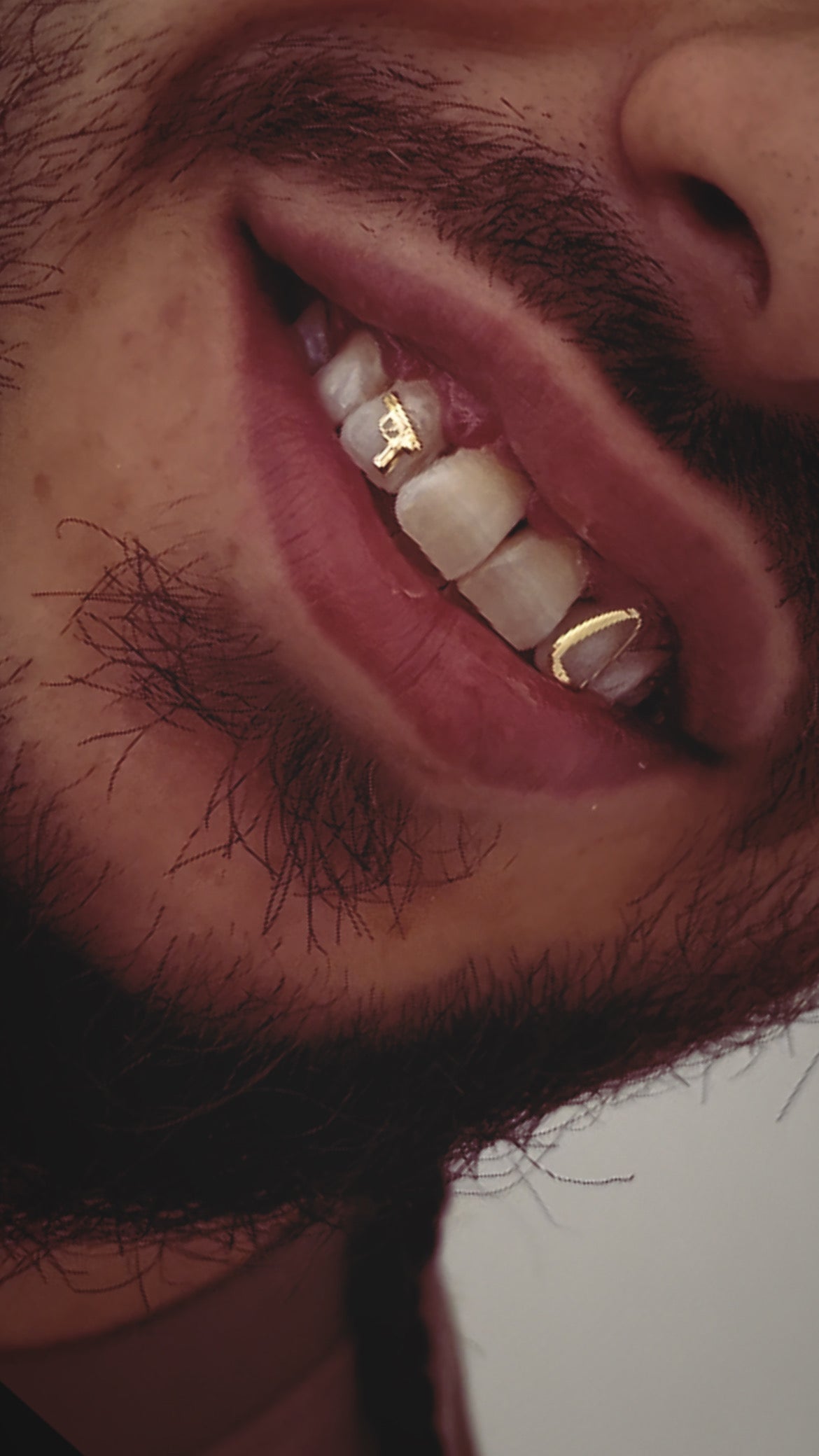Gold tooth gems online