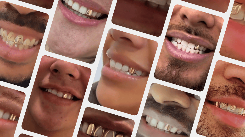 Gold Tooth Adore Smile