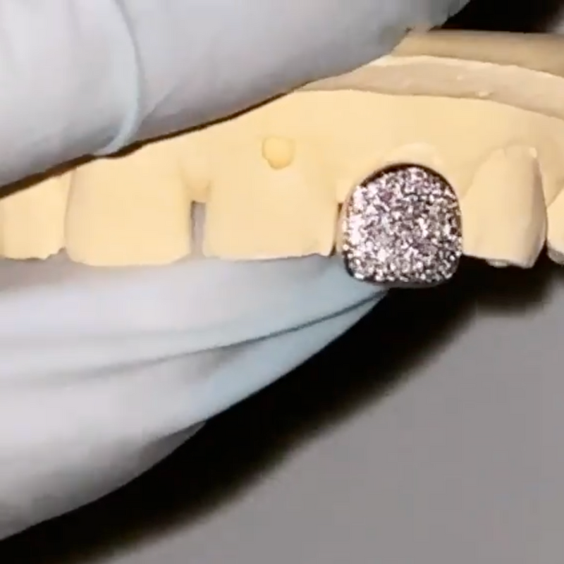 A close-up of a dental impression or tooth mold with a textured silver grillz applied to one tooth, held by a gloved hand against a neutral gray background.
