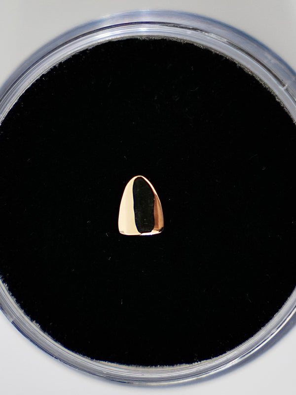 18k Gold Star Tooth Gem – Adore Smile