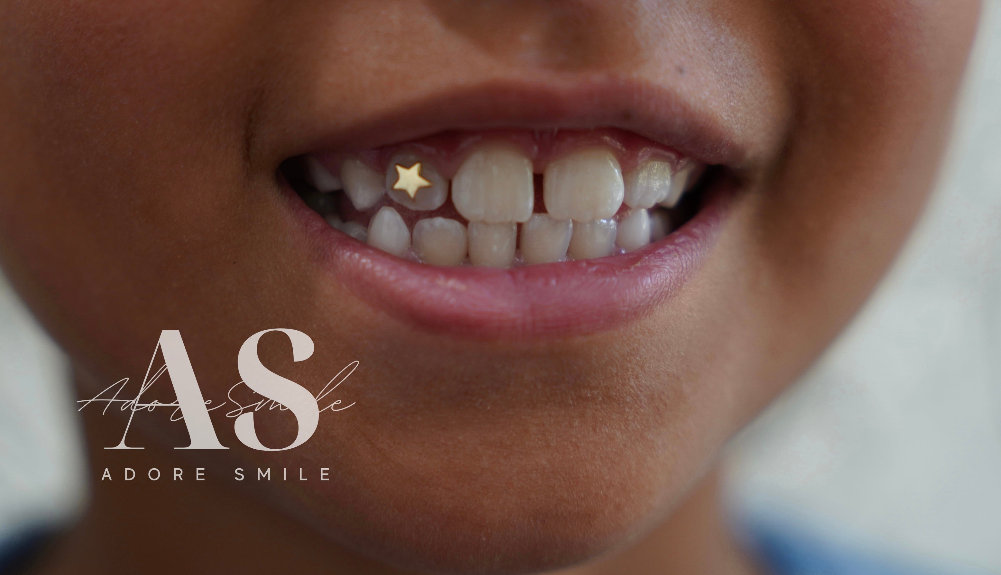 18k Gold Star Tooth Gem – Adore Smile