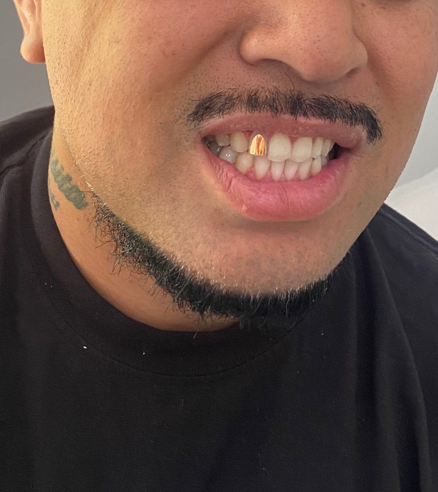 Azraq Tooth Cap Gold Tooth Cap