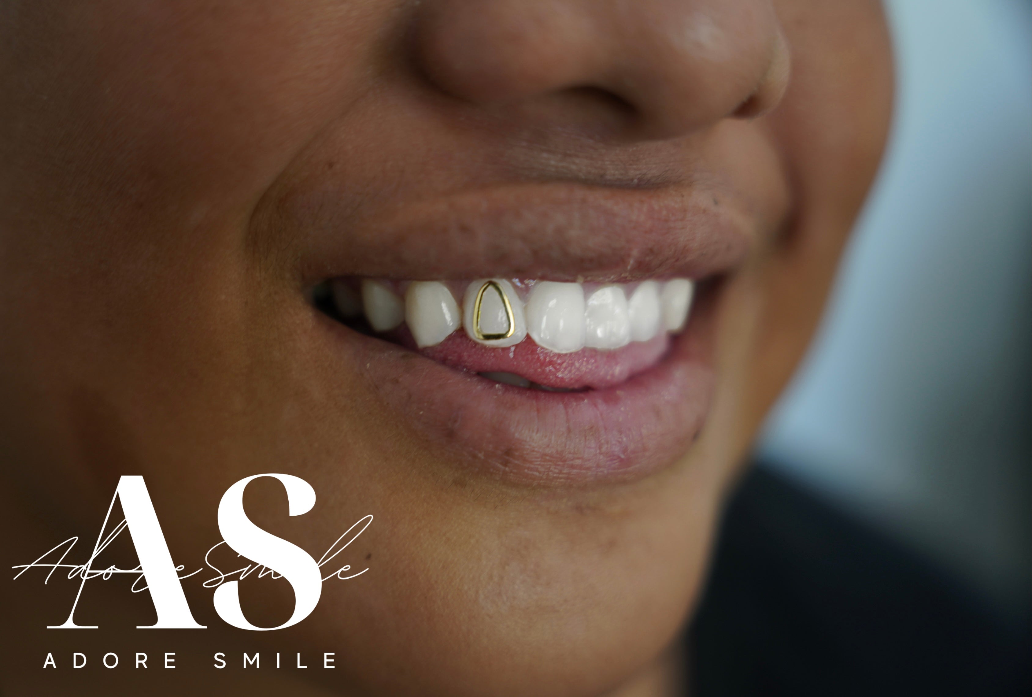 Small Gold Tooth Gold Tooth Outline Tooth Gem – Adore Smile
